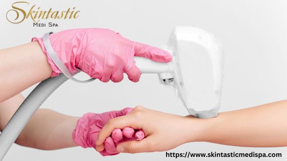 Laser Hair Removal in Riverside